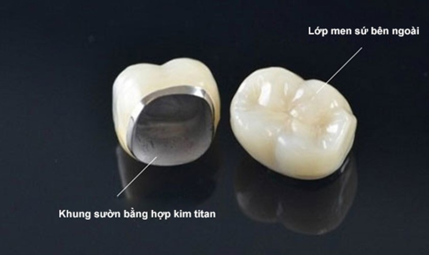 Cấu tạo răng Titan Cấu tạo răng Titan